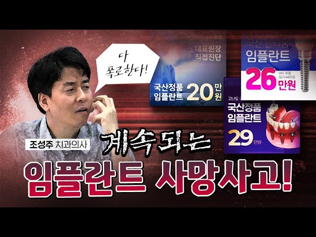 임플란트 하기 전에 꼭 보세요! (부모님에게 전해주세요)
